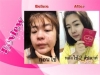 บอกลาสิวอักเสบ สิวอุดตัน สิวเสี้ยน เพียงเปิดใจใช้สบู่มาเวียร์ร่า 